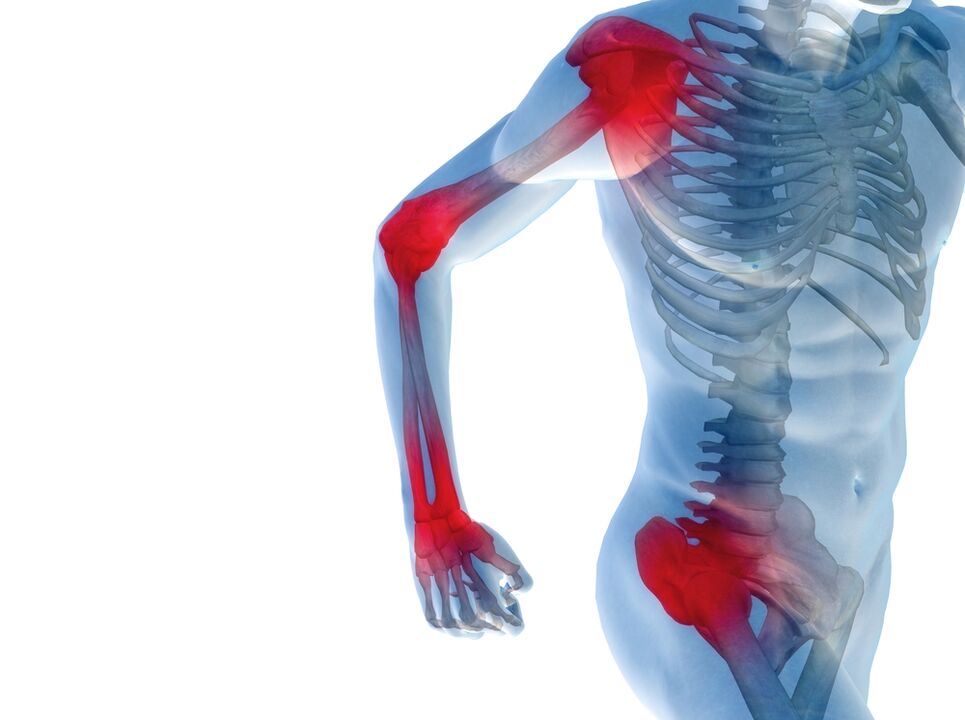 Pain in the joints of the arms and legs