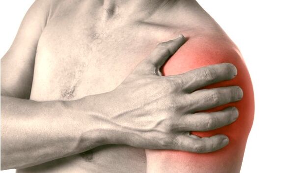 Swollen, red and enlarged shoulder - symptoms of arthrosis of the shoulder joint grade 2-3