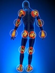 Location of articulations affected by arthrosis