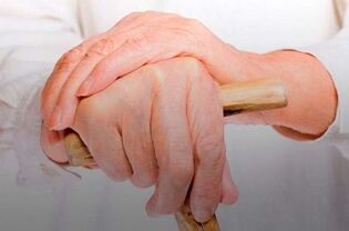 pain in finger joints with rheumatoid arthritis