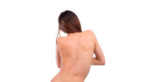 The sideways curvature (scoliosis) in the lumbar area